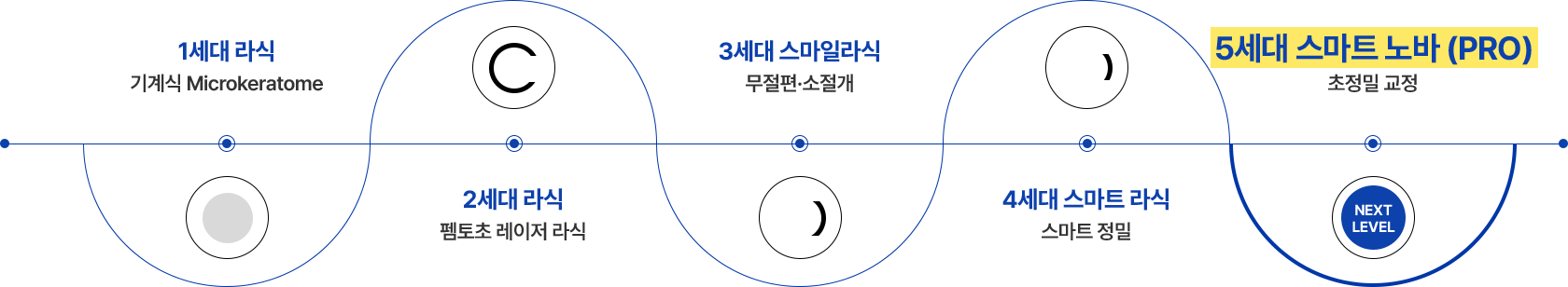 1세대 라식 : 기계식 Microkeratome, 2세대 라식 : 펨토초 레이저 라식, 3세대 스마일라식 : 무절편·소절개, 4세대 스마트 라식 : 스마트 정밀, 5세대 스마트 노바 (PRO) : 초정밀 교정