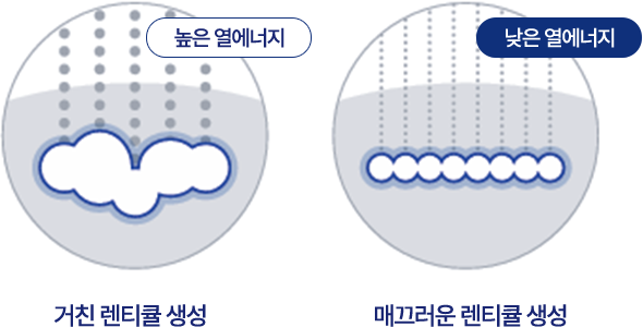 거친 렌티큘 생성 : 높은 열에너지, 매끄러운 렌티큘 생성 : 낮은 열에너지
