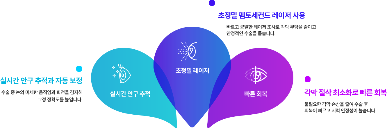 스마트 스마일 이란? 실시간 안구 추적, 초정밀 펨토세컨드 레이저 사용, 각막 절삭 최소화로 빠른 회복