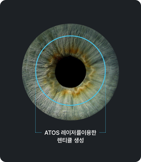ATOS 레이저를 이용한 레티큘 생성